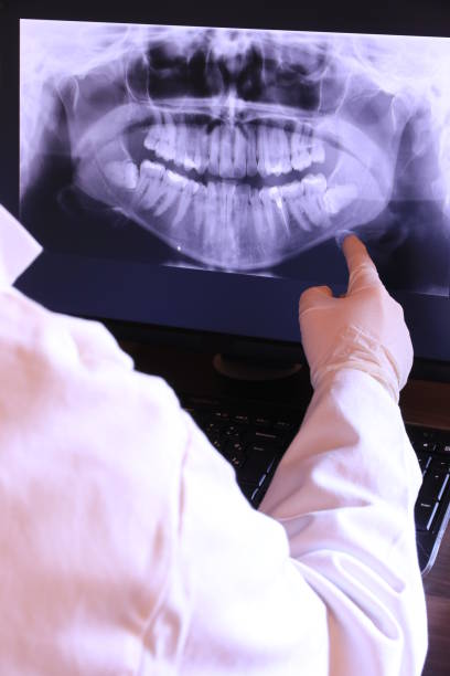 Best Emergency Treatment for Dental Infections or Abscesses in The Pinery, CO